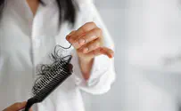 צילום: איסטוק Пациентка с коронавирусом стала лысеть