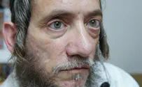 Eye disease so rare that I'm the only one in Israel who has it