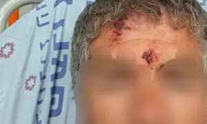 Violent clashes near Israeli farm leave two injured