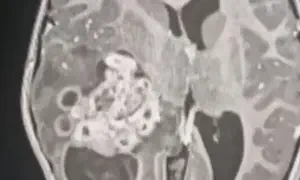 הניתוח שהציל את חייה של אריאלה