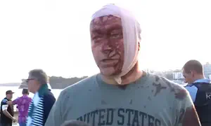 Арсен Островский ранен в голову в теракте в Сиднее