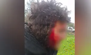 תקיפה קשה לעיני המצלמות