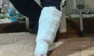 מה שהתגלה בגבס הפתיע את השוטרים