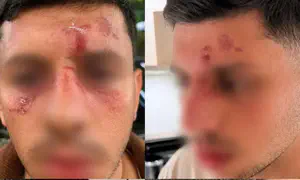 Young man spoke Hebrew and was attacked by masked men