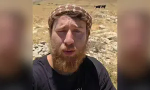 הבחירה החריגה של פעיל הגבעות