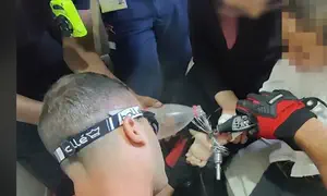 ידו של ילד נלכדה במקצף של מיקסר