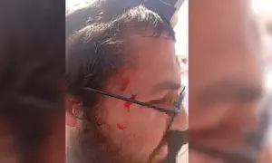 מטיילים הותקפו על ידי פורעים ערבים