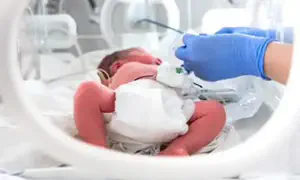 הסיבוך הקשה של תינוקת שנולדה בביתה