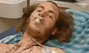 "נלחמתי במחבל - ואז ראיתי שאני מלא דם"