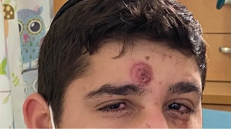 הנס של עזרא