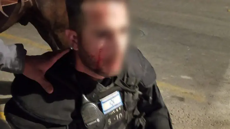 Полицейский, раненный камнем в лицо в ходе беспорядков в Иерусалиме