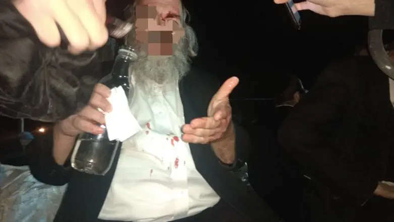 אחד הפצועים