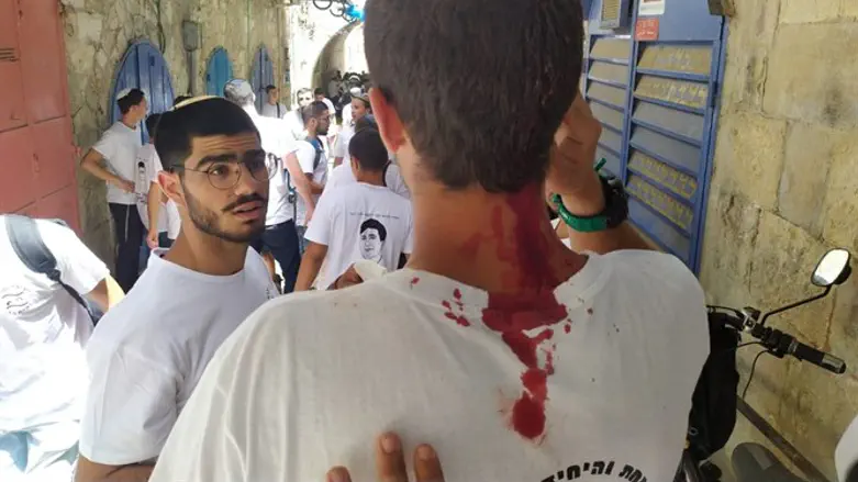 Friends of Yehuda Guetta injured in Old City