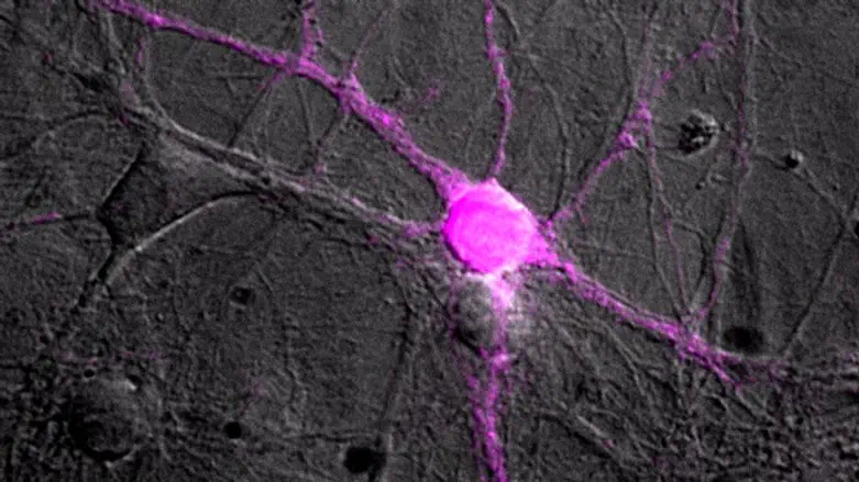 A neuron with its dendritic extensions expressing the mosquito-derived protein