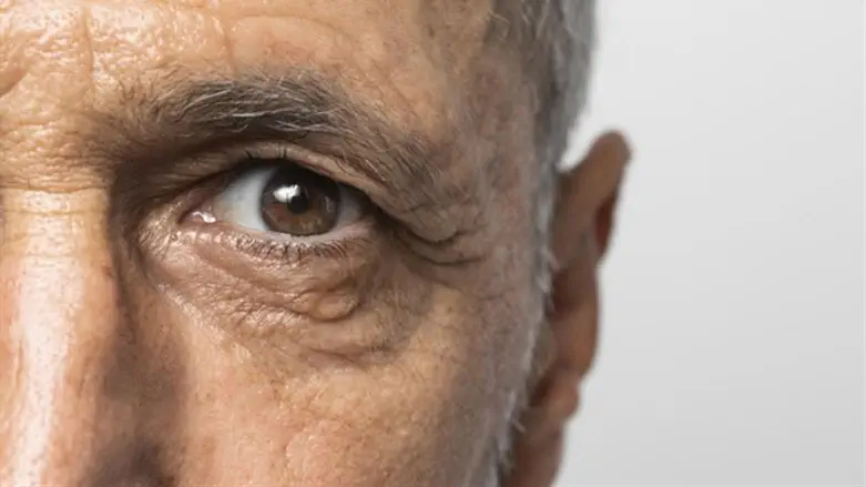 ניתוחים לפנים