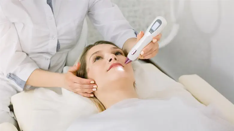 הסרת נקודות חן