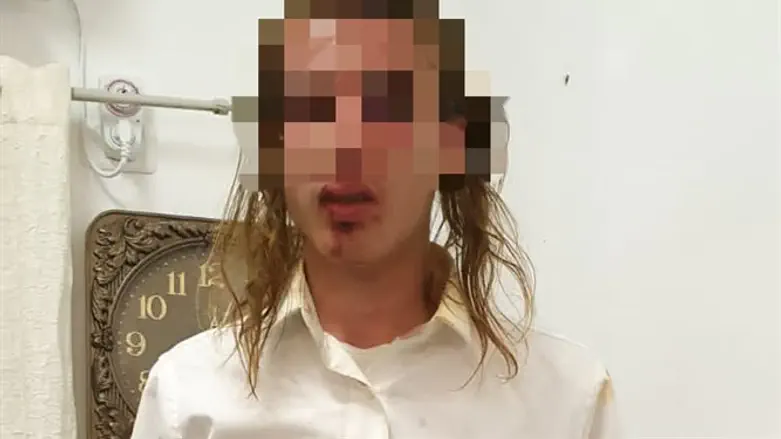 הערבים תקפו, המשטרה סגרה את התלונה