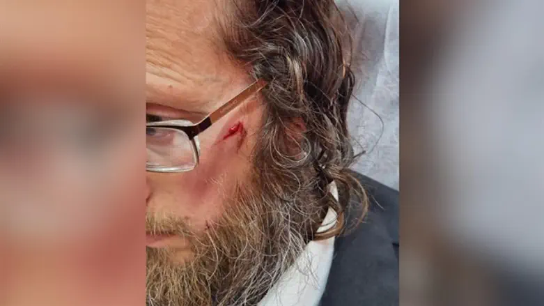 The Jewish man who was attacked