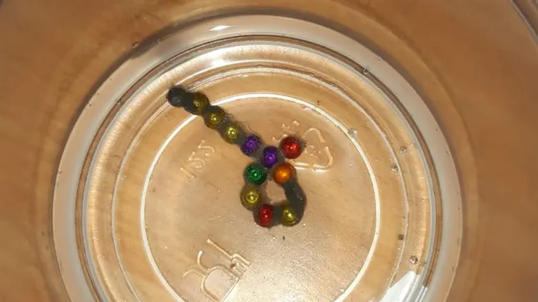 19 מגנטים בבטנו של התינוק