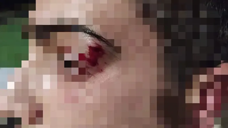 עינו הפצועה של מ'