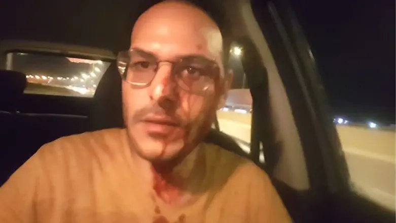 Авихай Марчиано после попытки линчевания