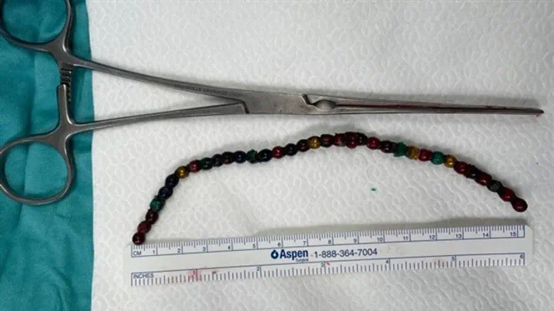 פעוט בן שנה וחודשיים בלע "מחרוזת"