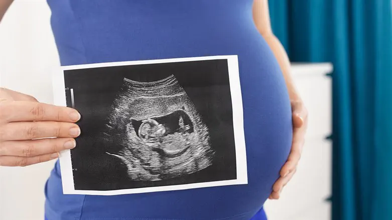 אולטרסאונד. אילוסטרציה