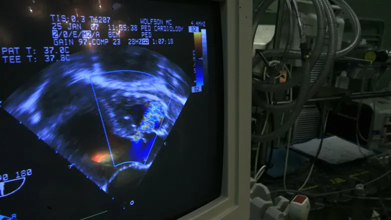 Ultrasound image