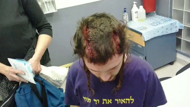 הצעיר שהותקף על ידי ערבים