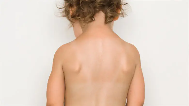 אילוסטרציה