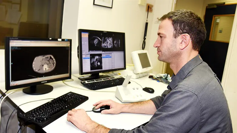 ד"ר גל בן אריה, רדיולוג במכון הדימות בסורוקה