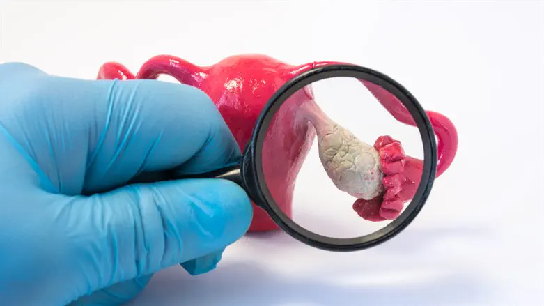 אילוסטרציה