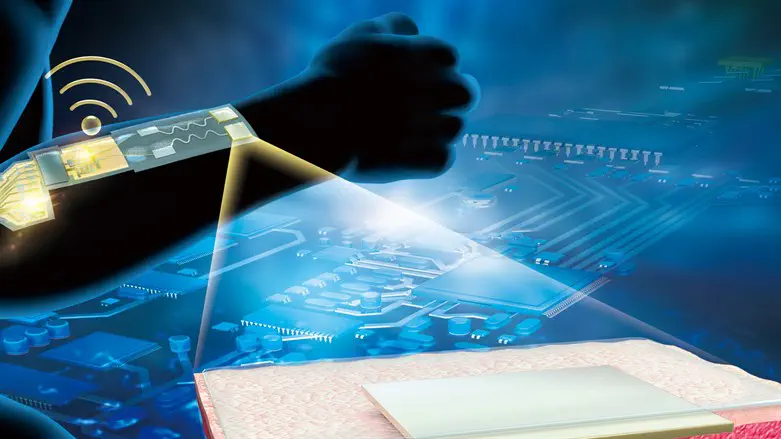 הדמיה של המחטים על היד