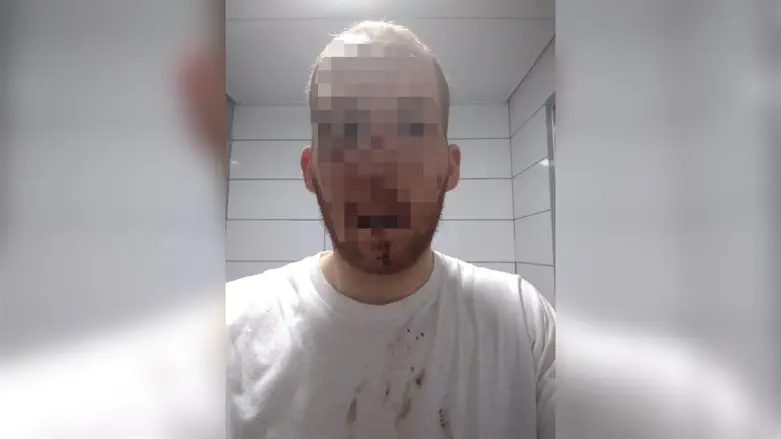 נ' לאחר הפיגוע