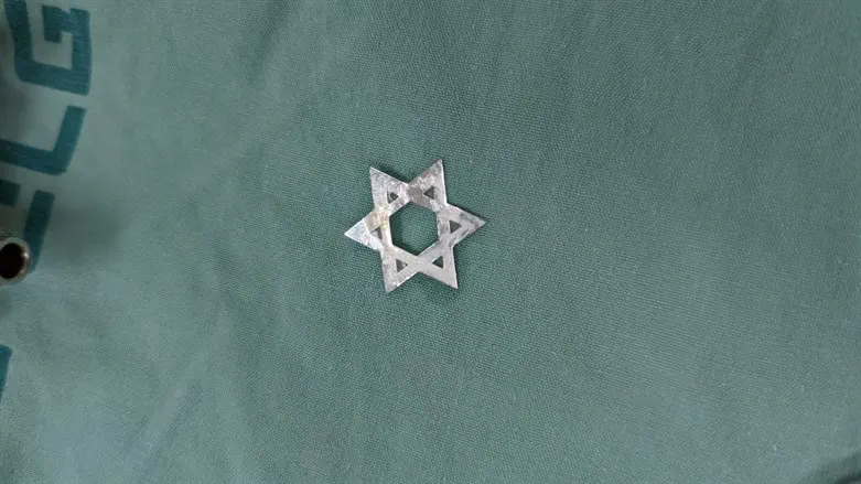 הקישוט שהוצא מקנה הנשימה של הנער