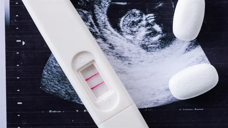 Аборт (иллюстрация)