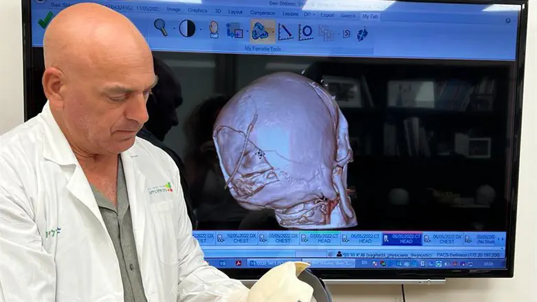 פרופ שגיא הרנוף עם ההתקן המיוחד