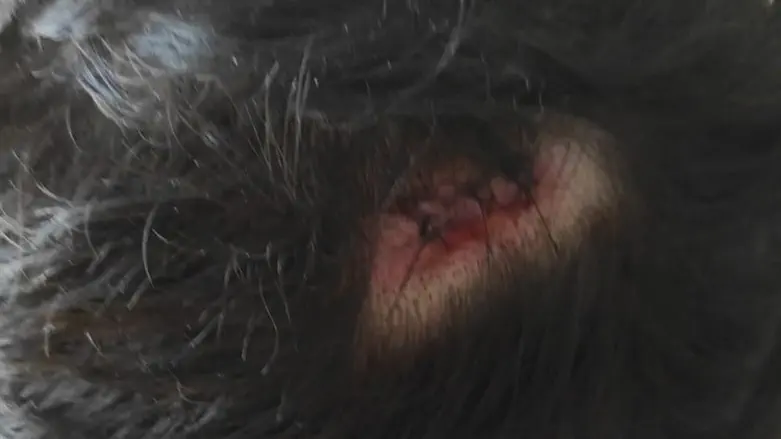 ערבים תקפו יהודים עד עילפון