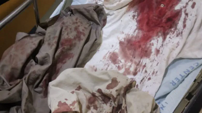 הבגדים של הקרבן