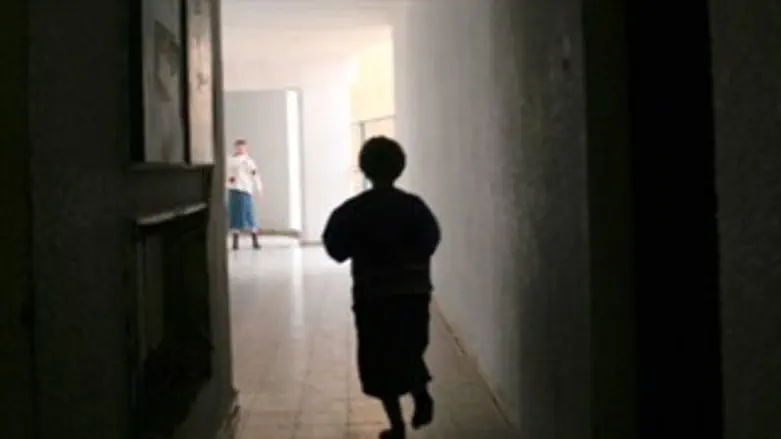 תסמונת דאון פיגור