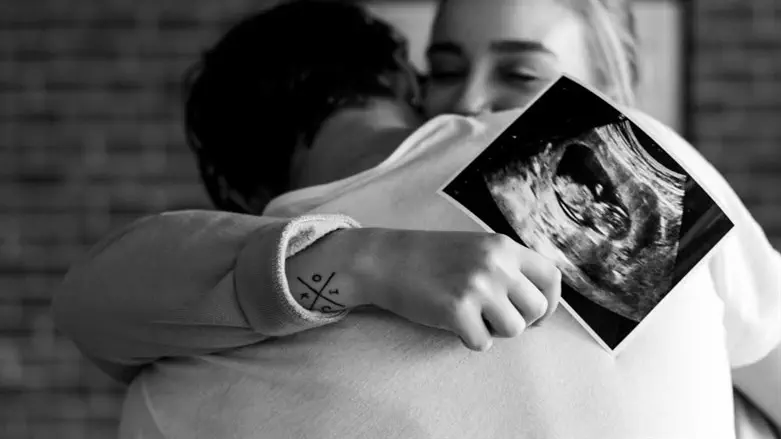 אולטרא סאונד