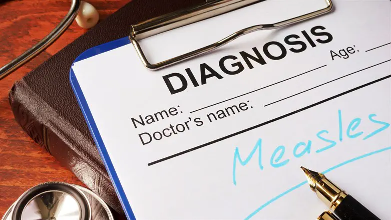 Measles diagnosis