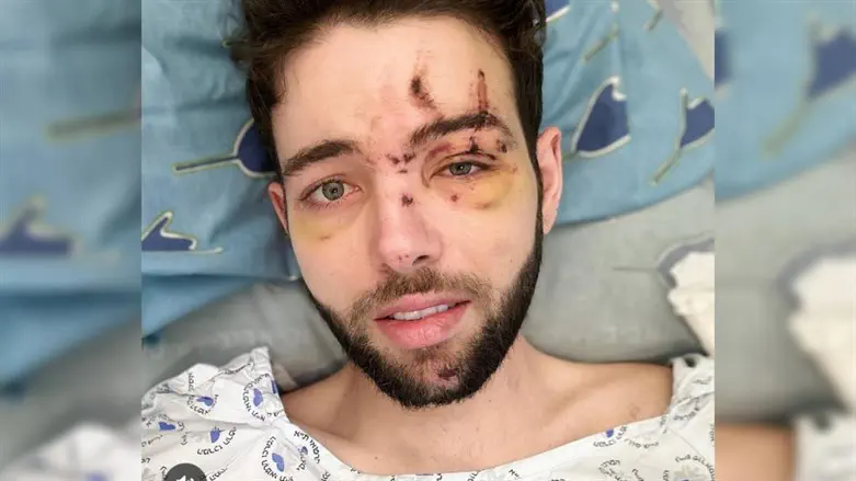 יוני קדם בבית החולים