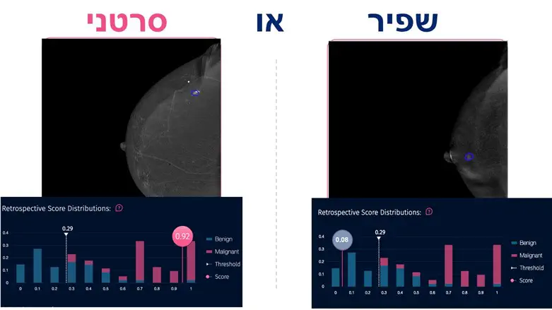 המערכת של חברת MICA נועדה לסייע באיתור מוקדם של המחלה