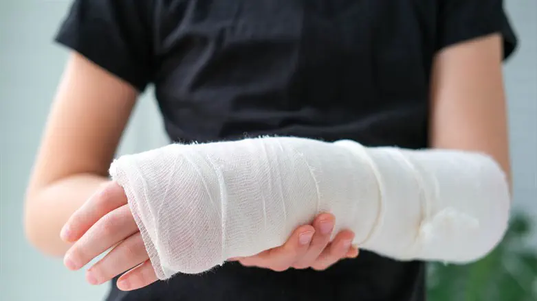 יד שבורה. אילוסטרציה