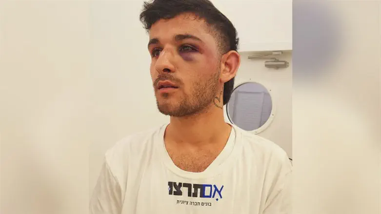 הצעיר שהותקף