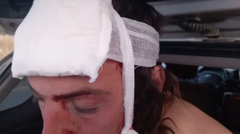 mans struck in the head by a stone