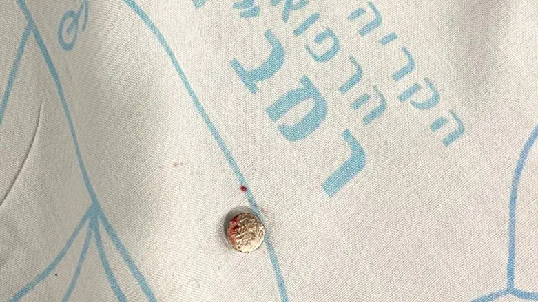 מה שגילו הרופאים בראש