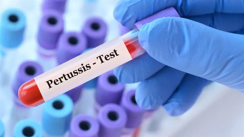 Pertussis שעלת