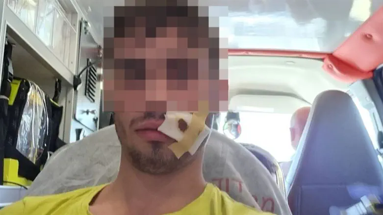 The yeshiva student who was attacked by an Arab